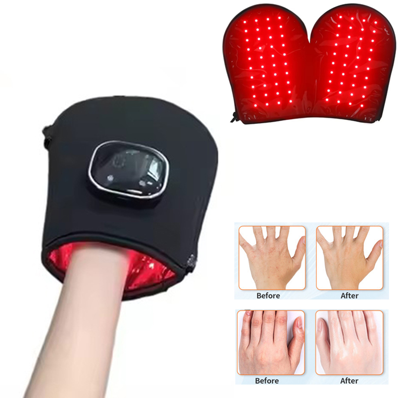Nieuw Rood Lichttherapie Appar - Heated Gloves Electric recensie en prijs
